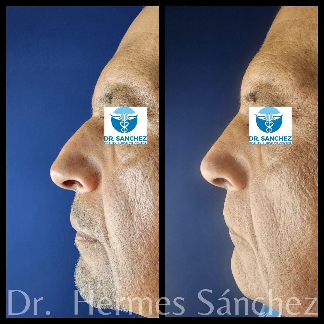 Galería - Transformación 14